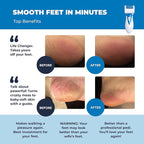 Electric Callus Remover: Own Harmony Professional Pedicure Tools Foot Care - Image 2