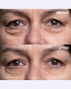Wrinkles Schminkles Under Eye Wrinkle Patches, Smooth Eye Wrinkles, Crows Feet - Image 3