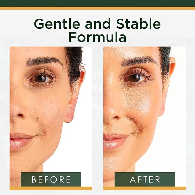 Tree of Life 20% Vitamin C+ Serum - Image 3