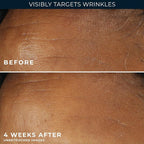 RoC Retinol Correxion Deep Wrinkle Daily Face Moisturizer - Image 6