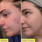 Good Molecules 10% Azelaic Acid Treatment - Image 3
