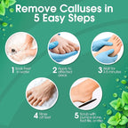 DeEnti Callus Remover for Feet, Extra Strength Foot Callus Remover Gel - Image 4