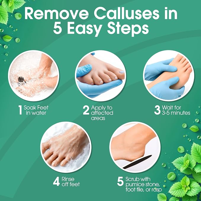 DeEnti Callus Remover for Feet, Extra Strength Foot Callus Remover Gel - Image 4