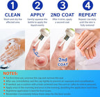 Ulensy Corn Remover Liquid for Toes Feet: 20ml Salicylic Acid for Foot Corns - Image 5