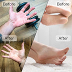 AprElm Portable Electric Hand & Foot Callus Remover - Image 3