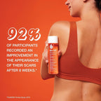 Bio-Oil Skincare Body Oil Serum, Face and Body Moisturizer - Image 3