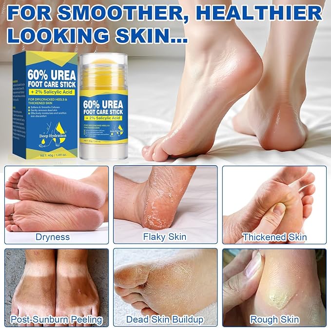 60% Urea Stick with 2% Salicylic Acid, Moisturizer - Image 7