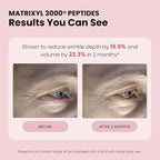 Rose Water Spray for Face with Matrixyl 3000, Glycerin & Aloe Vera - Image 4