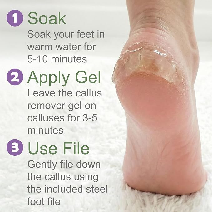 Dr. Entre's Callus Remover Gel & Foot File: Extra Strength Callus Remover - Image 6