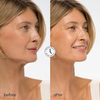 MAREE V Line Lifting Mask with Hyaluronic Acid – Deep Collagen Face Mask - Image 4