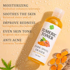 Toner for Dark Spots Turmeric Dark Spot Corrector, Facial Toner for Acne Prone - Image 4