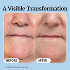 Vibriance Super C Serum for Mature Skin - Image 5