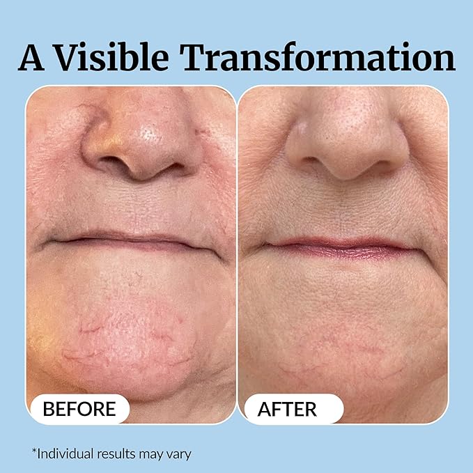 Vibriance Super C Serum for Mature Skin - Image 5