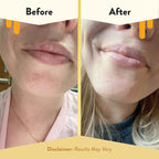 ECZEMA HONEY Nourishing Lip Balm - Image 4