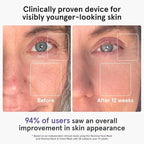 iRestore LED Face Mask for Youthful Skin, Fine Lines, Dark Spots - Image 2