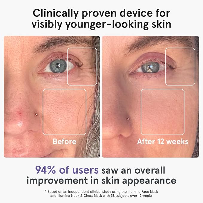 iRestore LED Face Mask for Youthful Skin, Fine Lines, Dark Spots - Image 2