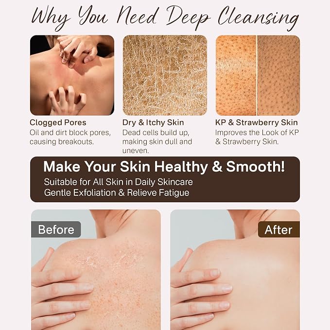 Exfoliating Gloves 2 Pcs, Korean Exfoliating Mitts, Body Scrub - Image 6
