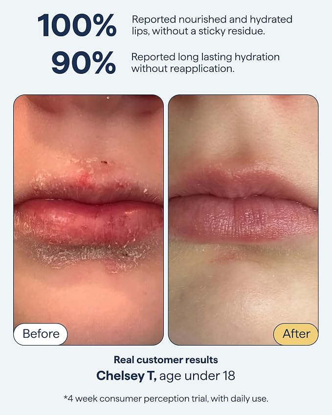 Remedy for Dry Lips | All-In-One Lip Treatment | Hydrating and Healing Lip Balm - Image 3