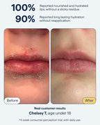 Remedy for Dry Lips | All-In-One Lip Treatment | Hydrating and Healing Lip Balm - Image 3