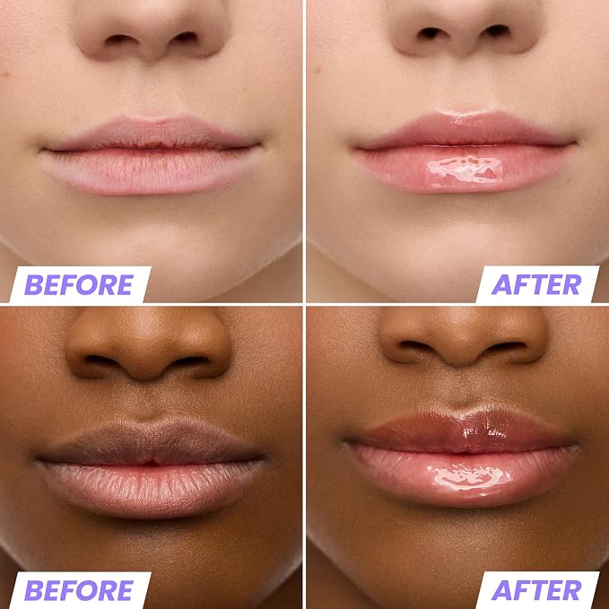 Wonderskin Lip Oil Rehab Serum - Image 3