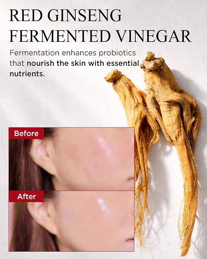 DANAHAN Bonyongo Red Ginseng Vinegar Toner – Rich Essence Toner - Image 5