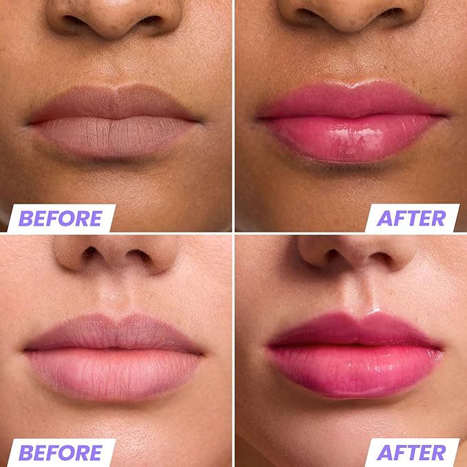 Wonderskin Lip Oil Rehab Serum - Image 2