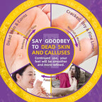 Foot Exfoliating Scrub, Sugar Scrub, Dead Skin Remover - Image 3