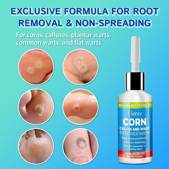 Ulensy Corn Remover Liquid for Toes Feet: 20ml Salicylic Acid for Foot Corns - Image 3
