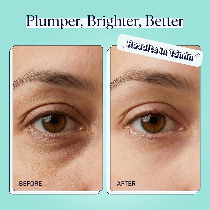 SpaLife Cooling Cucumber Eye Pads | Mothers Day Gifts & Korean Dark Circles & - Image 4