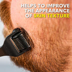 The Beard Club Premium Derma Roller - Image 4