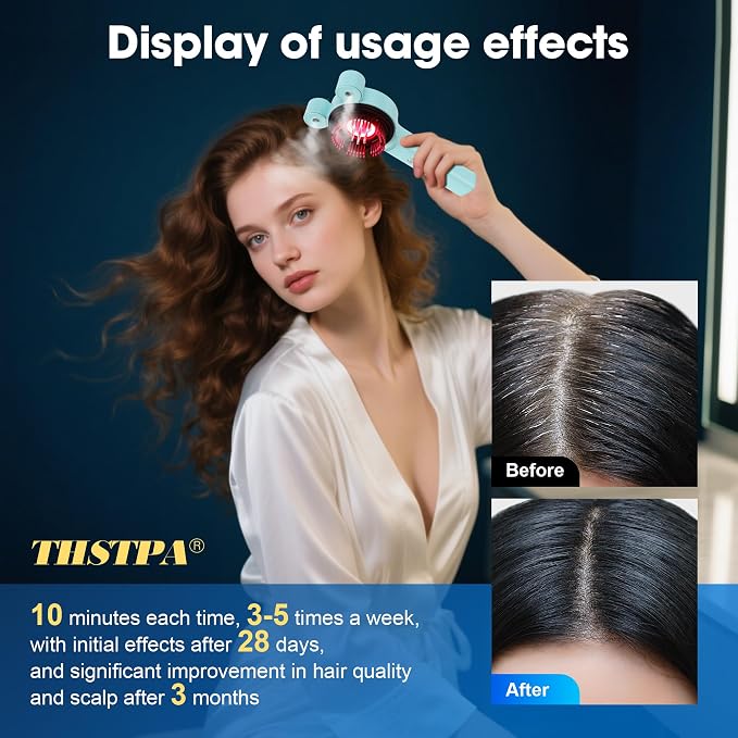 Upgraded 4 in 1 Scalp Massager Hair Growth, Electric Scalp Massager, Hair Oil - Image 6