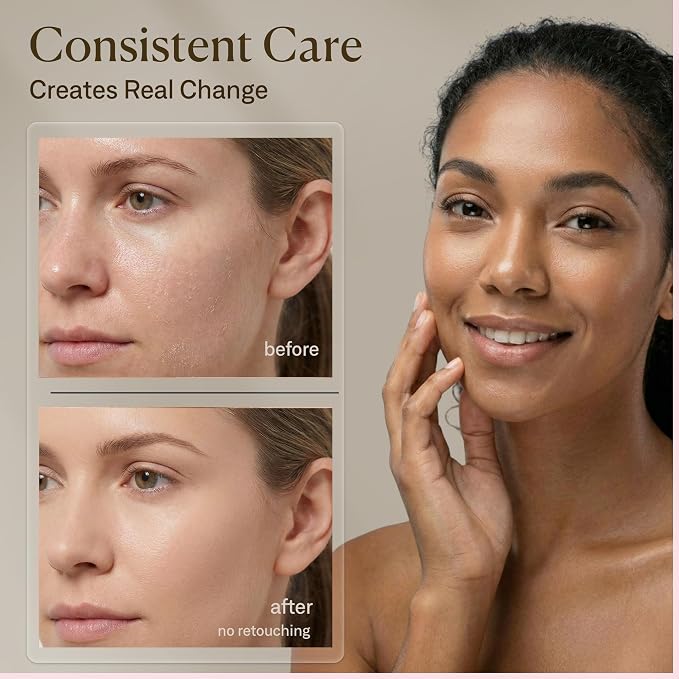 Facial Steamer Spa Kit with Complimentary 17 Skin Care Tools | Face Steamer - Image 8