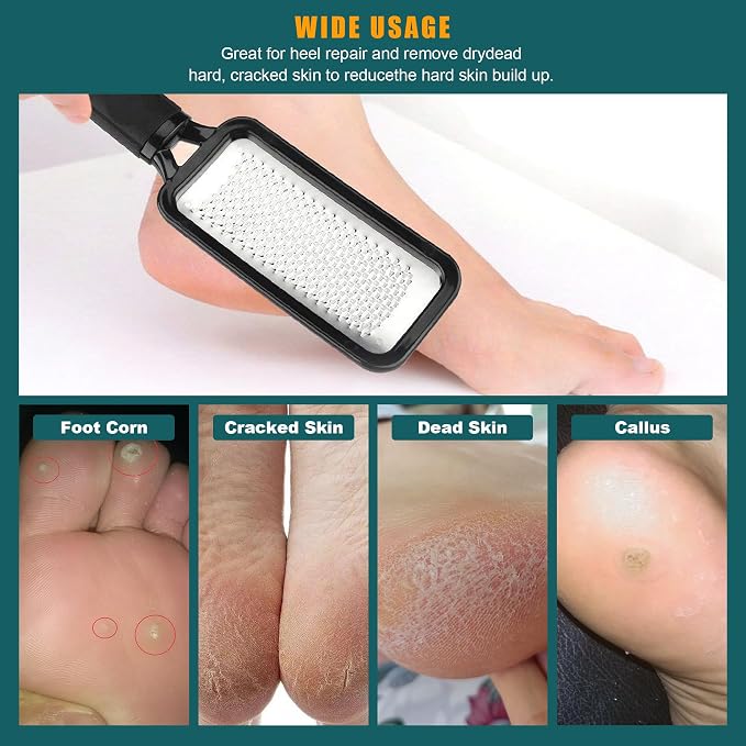 Foot Files Foot Scrubber Pedicure, Stainless Steel Callus Remover - Image 7
