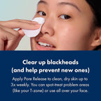 Hero Cosmetics Pore Release Blackhead Clearing Solution, Exfoliating 2% - Image 4