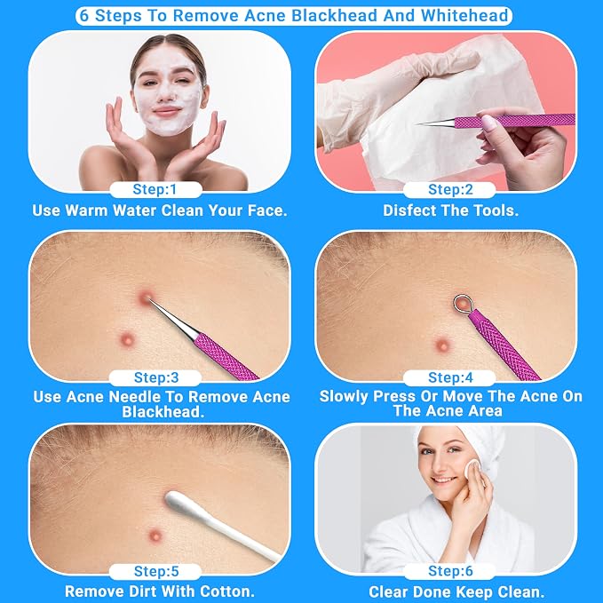 EFAH Care 2Pcs Stainless Steel Pimple Extractor Acne Treatment Tool Surgical - Image 5