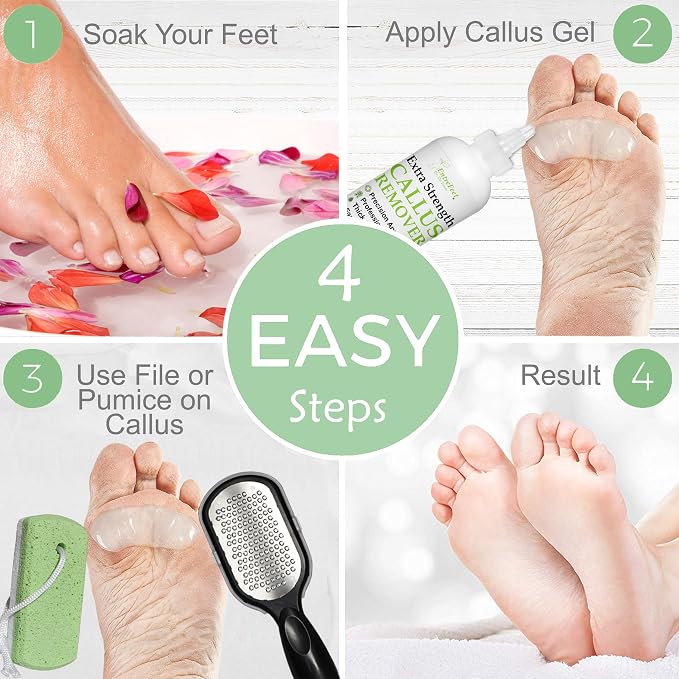 Dr. Entre's Callus Remover Gel Kit - Image 6