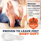 Own Harmony Electric Callus Remover - Image 4