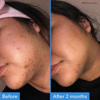 Good Molecules Discoloration Correcting Serum Pack 3 – 75 ml / 2.5 fl oz Each | - Image 3