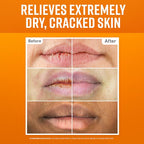O'Keeffe's Lip Repair Lip Balm Set - Image 2