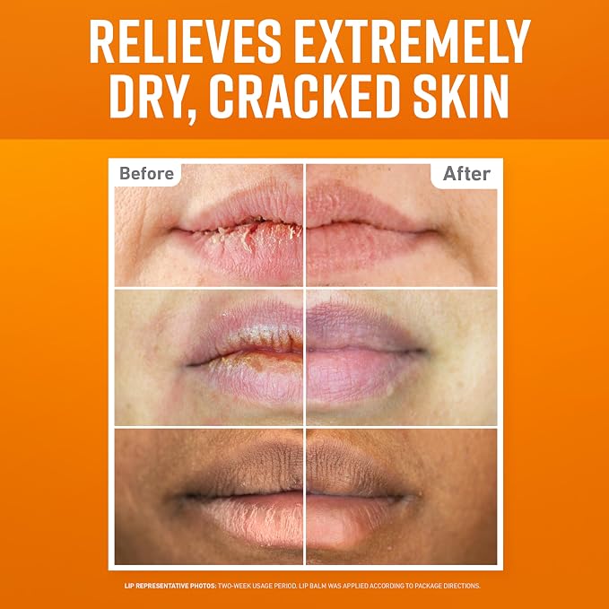 O'Keeffe's Lip Repair Lip Balm Set - Image 2
