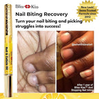 Bliss Kiss | 1 Crisp Fragrance | Nail Oil Cuticle Pen w/Vitamin E & Jojoba⏤Nail - Image 2