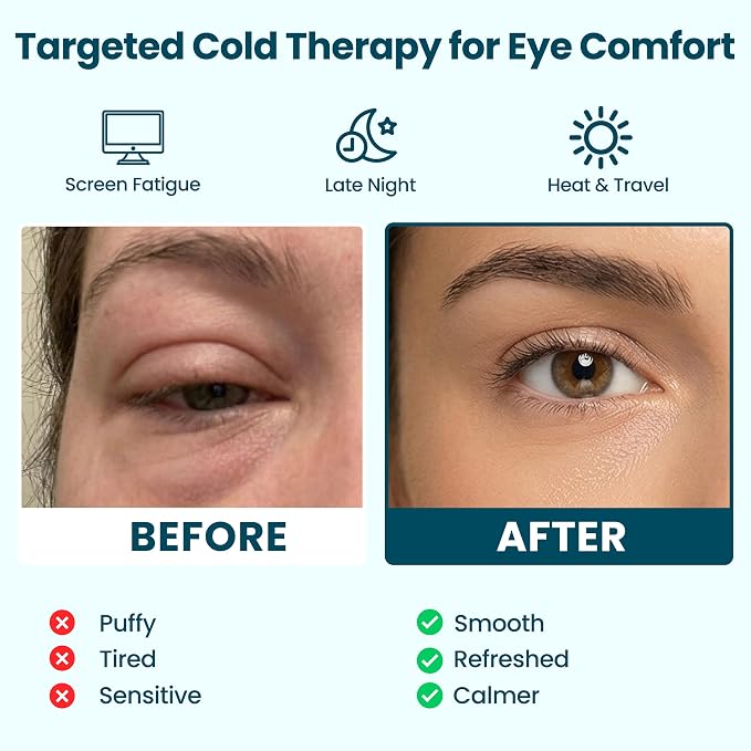 Eye Serenity CHILL Self Cooling Eye Mask - Image 5