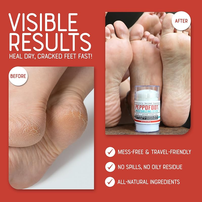 Rinse Bath & Body Peppofoot Heel Balm Stick - Image 6