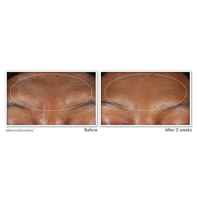 RoC Retinol Correxion Deep Wrinkle Serum Facial Cleanser - Image 4