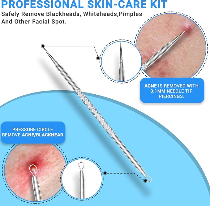 EFAH Care 2Pcs Stainless Steel Pimple Extractor Acne Treatment Tool Surgical - Image 3