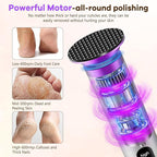 Electric Foot Callus Remover - Image 4