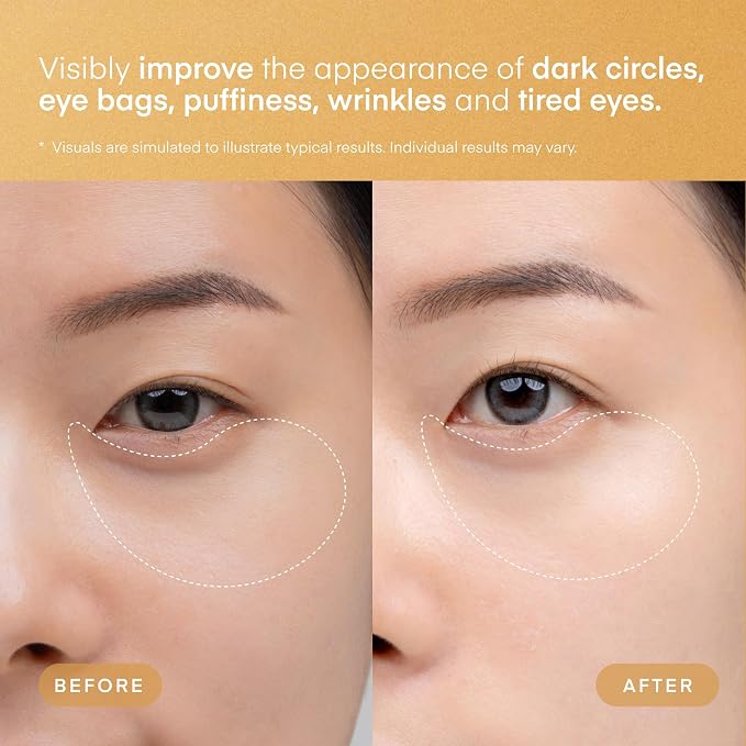 TEREZ & HONOR 24K Gold Retinol Under Eye Patches - Image 5