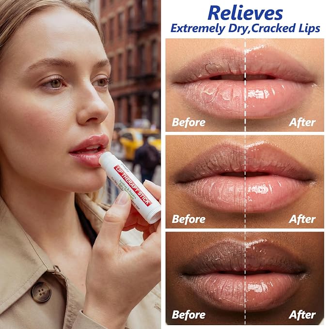 Dmsky Lip Therapy Lip Balm Stick, 10 Natural Berry Flavor Healing Hydrating - Image 4