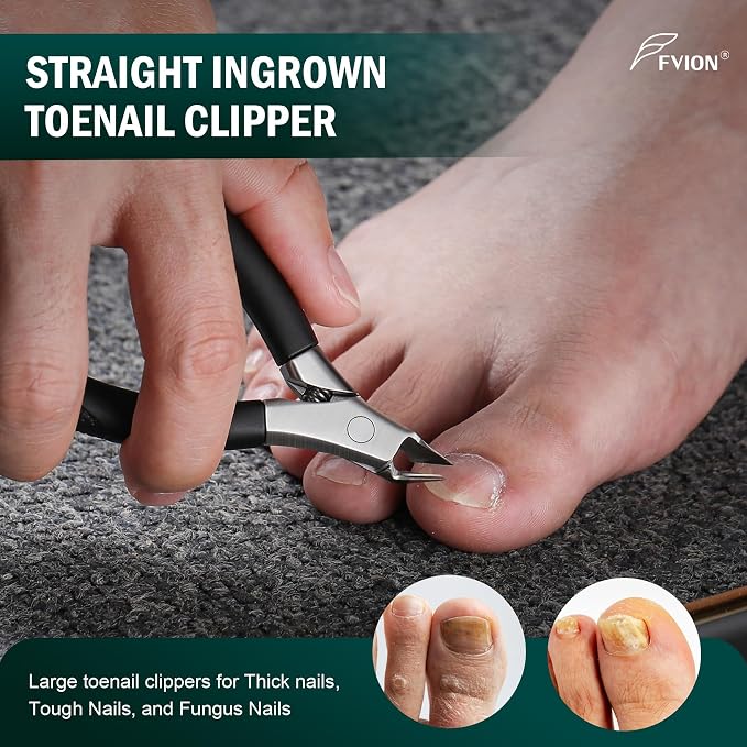 FVION Ingrown Toenail Tools Kit 5 Pcs, Toenail Clippers - Image 2