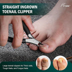 FVION Ingrown Toenail Tools Kit 5 Pcs, Toenail Clippers - Image 2